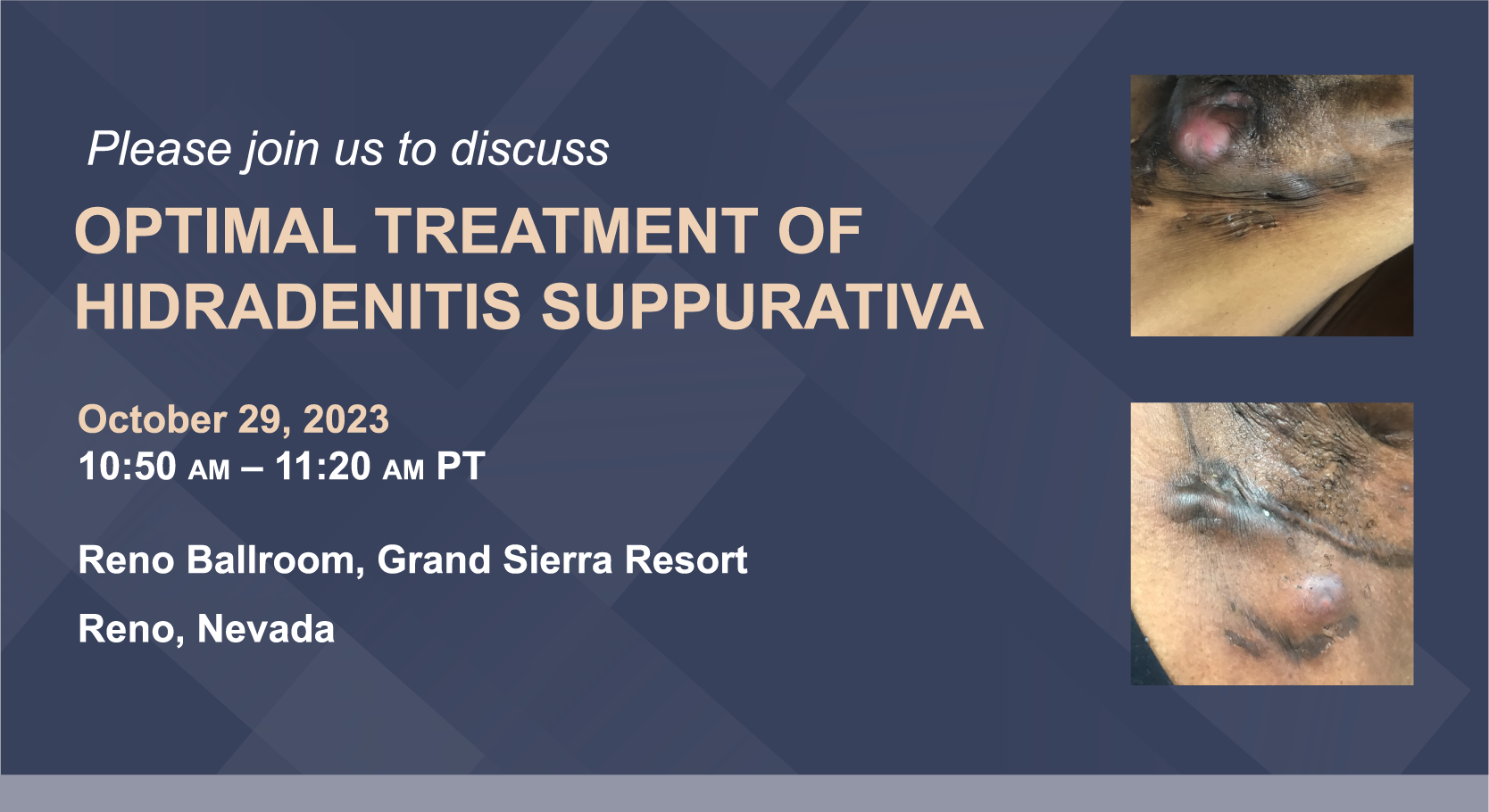 Novartis' Commitment in Rheumatology. Sunday, November 23, 2023 6PM PT. Hilton Bayfront, Indigo 204(AB), San Diego, California